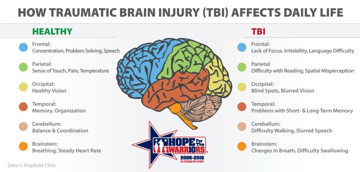 TBI-graphic (5)
